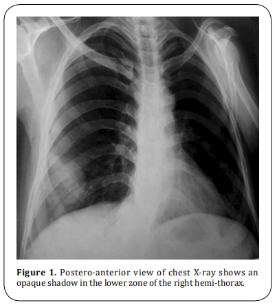 Figure 1.  